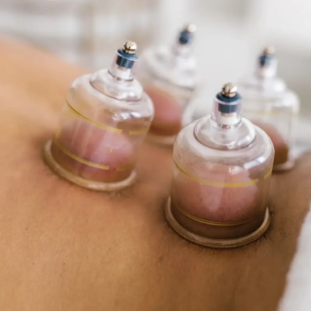cupping_massage_dubai